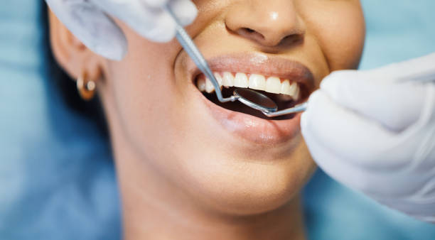 Best Dentist for Dental Trauma  in Northwood, OH